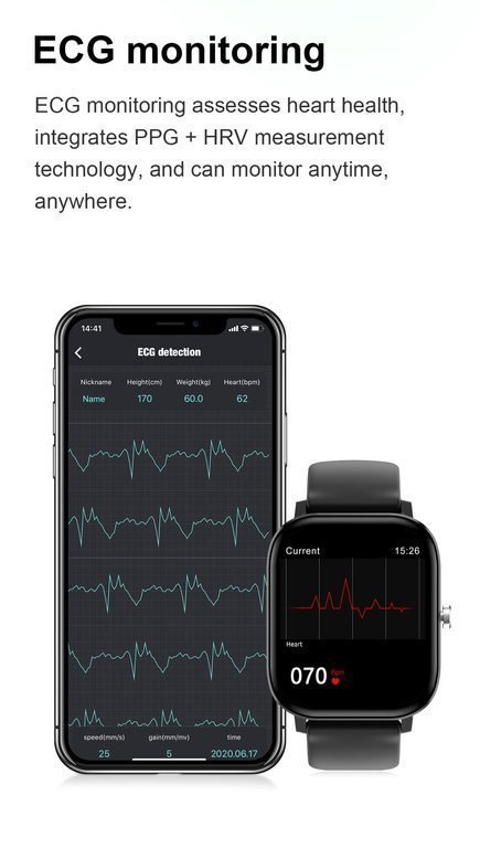 SMARTWATCH DAMSKI PACIFIC 20-4 - EKG, WYKONYWANIE POŁĄCZEŃ (sy017d)